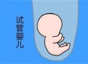 培养厦门捐卵宝宝艺术细胞的小技巧